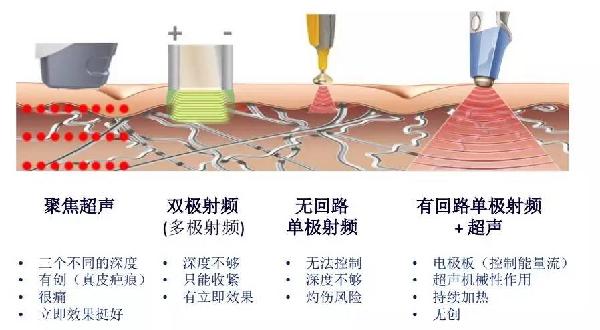 前沿科技引领，创新溶脂技术盘点：揭秘最新美容塑形秘籍